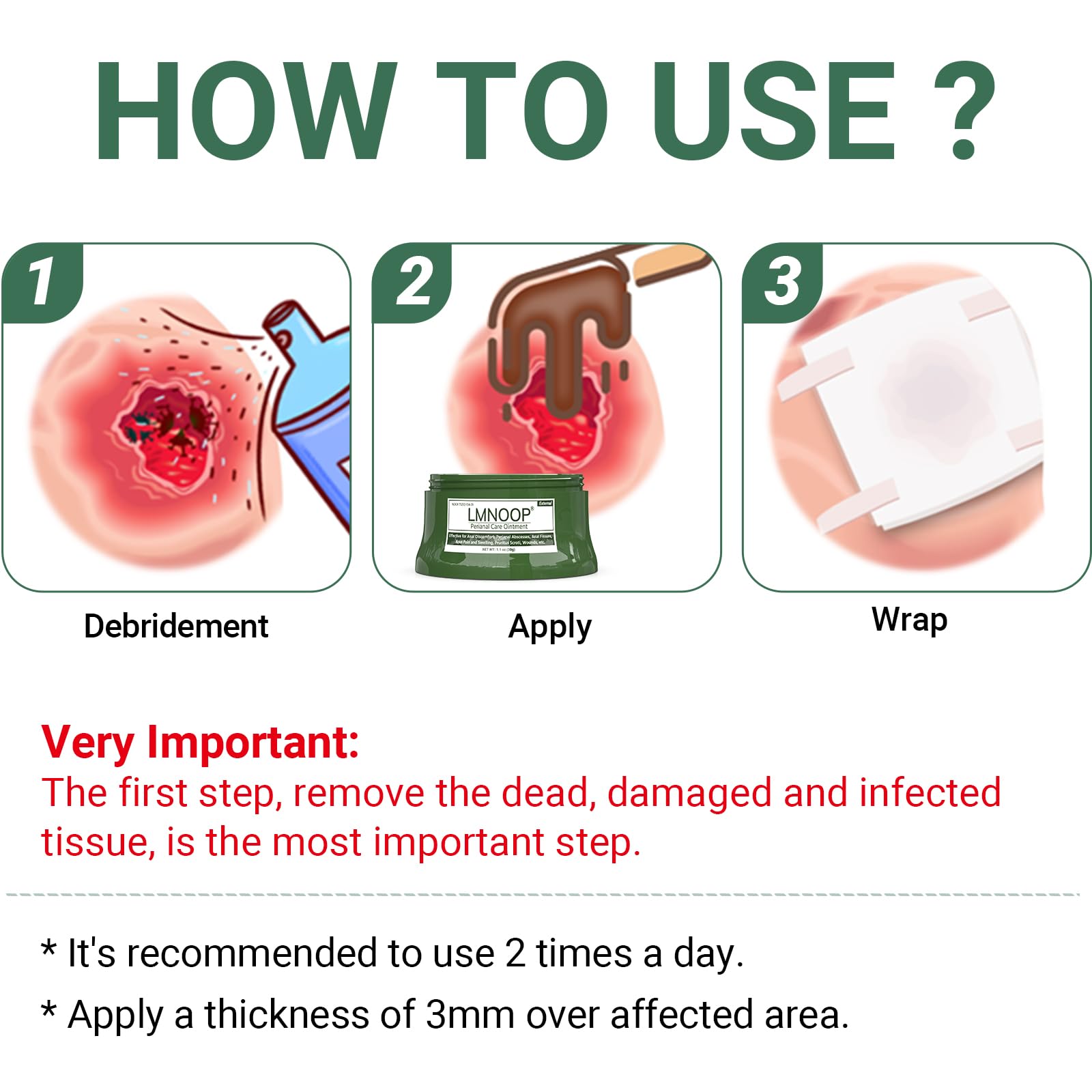 Perianal Repair Ointment for Anal Fissures & Hemorrhoid Relief