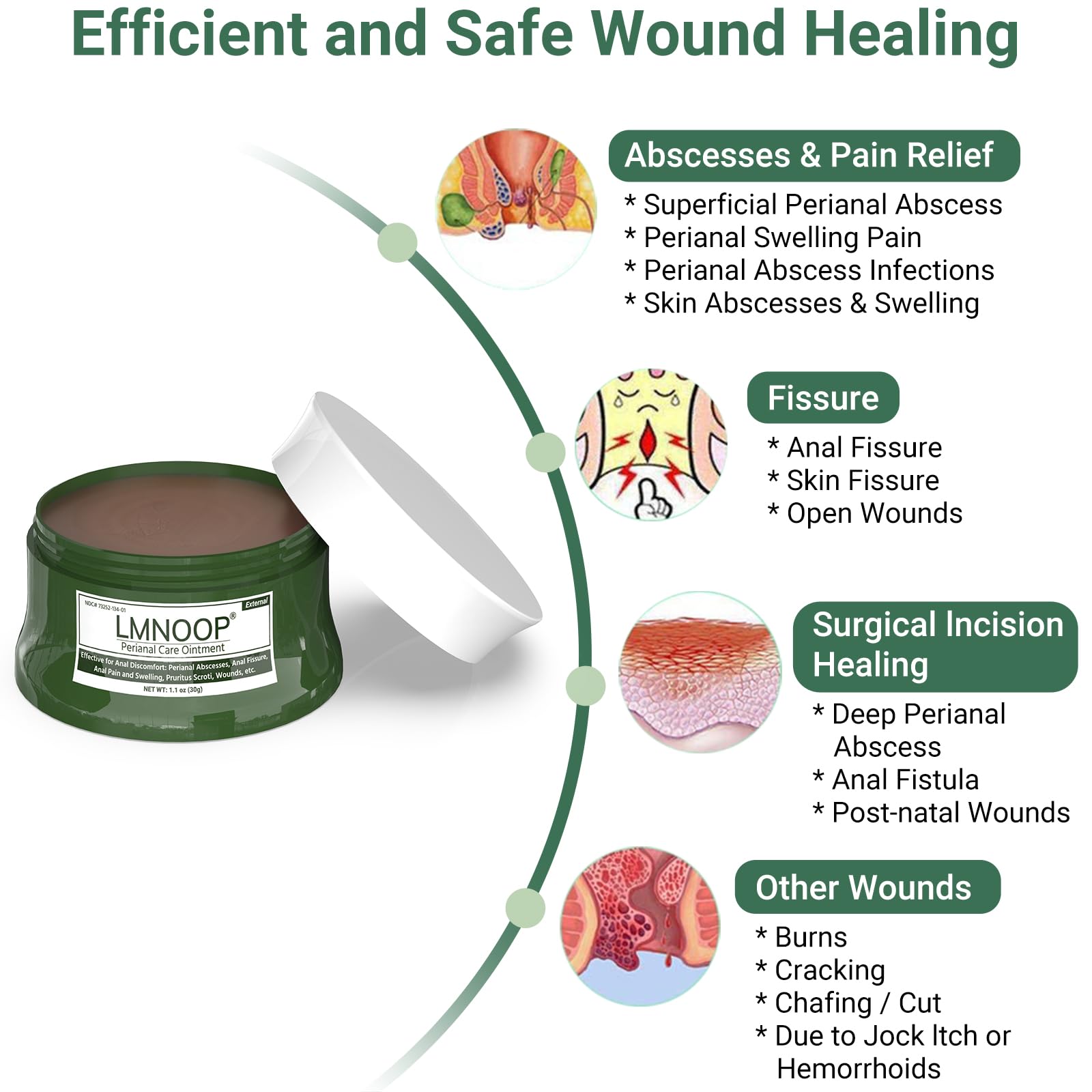 Perianal Repair Ointment for Anal Fissures & Hemorrhoid Relief